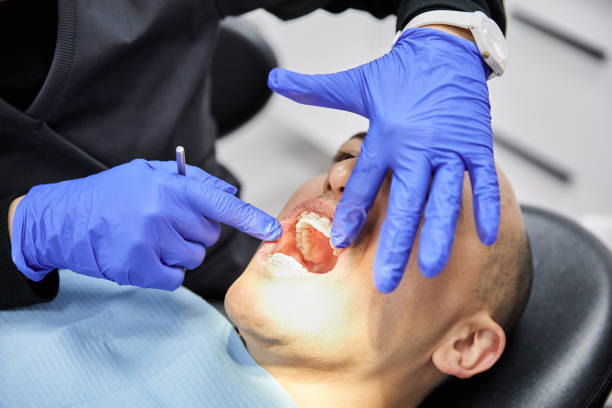 Best Emergency Tooth Extraction in Kaysville, UT